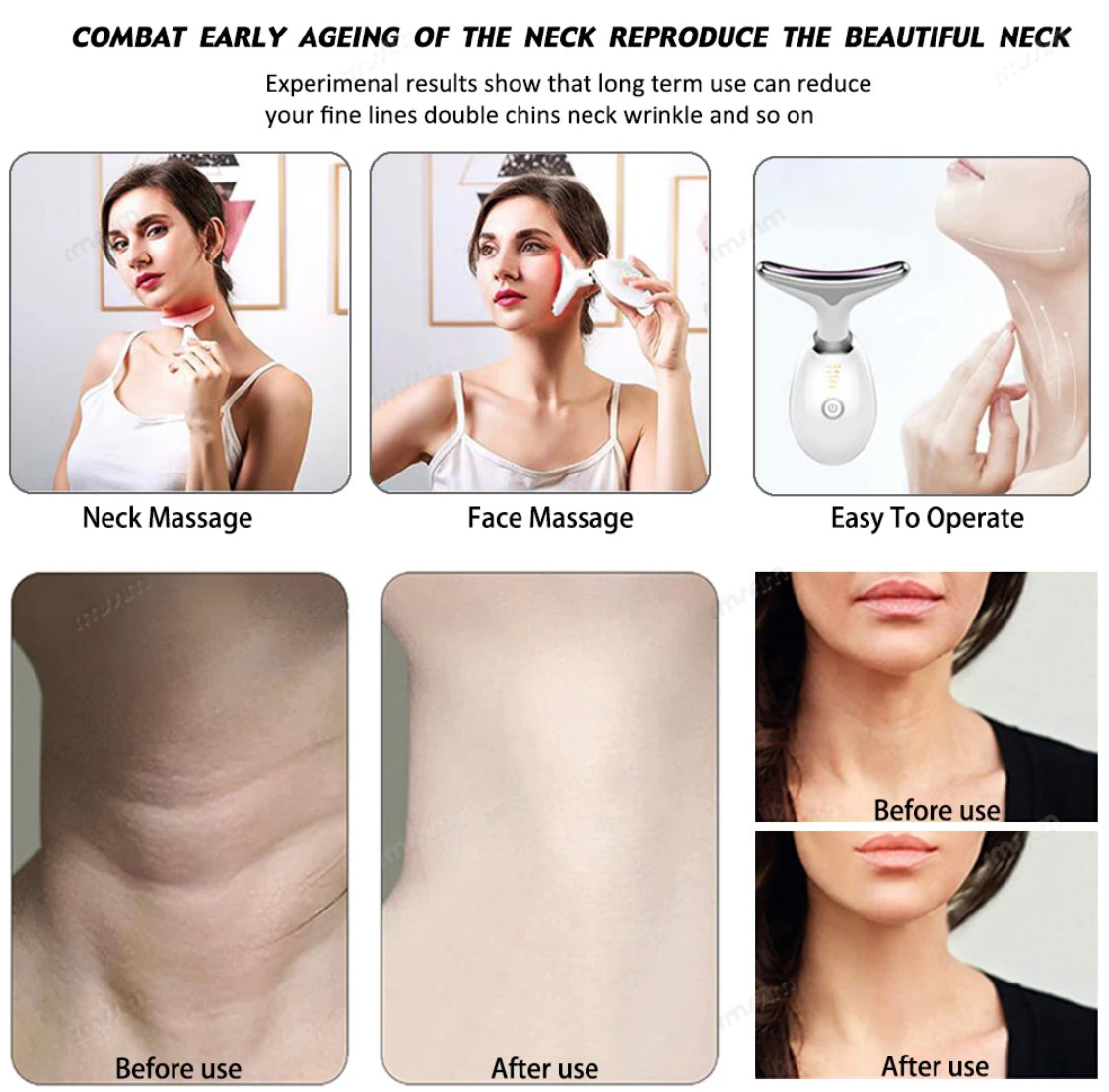 Faceshaper™ LED Photonen Therapie Schönheitsgerät